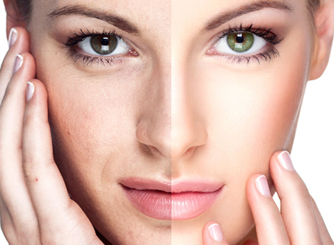 Rejuvenecimiento Facial, Dr Andres Gomez